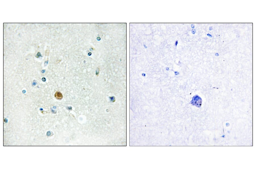 Immunohistochemistry - Anti-IRF3 Antibody (B0667) - Antibodies.com