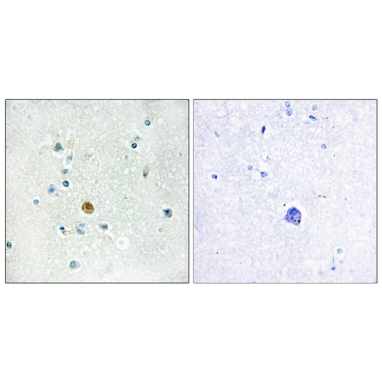 Immunohistochemistry - Anti-IRF3 Antibody (B0667) - Antibodies.com