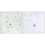 Immunohistochemistry - Anti-IRF3 Antibody (B0667) - Antibodies.com