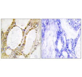 Immunohistochemistry - Anti-IRF2 Antibody (C10366) - Antibodies.com