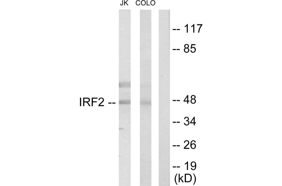 Western Blot - Anti-IRF2 Antibody (C10366) - Antibodies.com