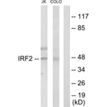 Western Blot - Anti-IRF2 Antibody (C10366) - Antibodies.com