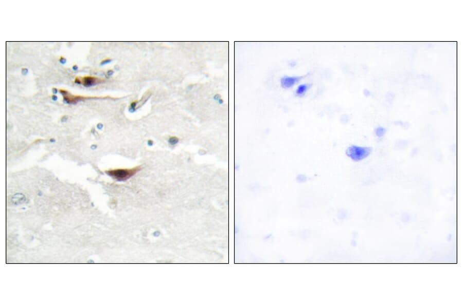 Immunohistochemistry - Anti-IPPK Antibody (C11708) - Antibodies.com
