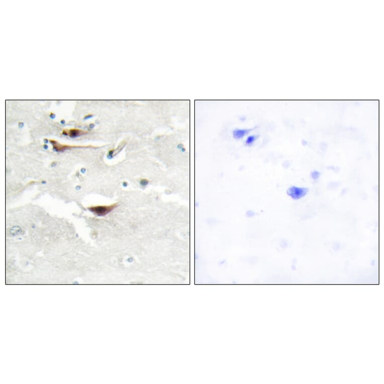 Immunohistochemistry - Anti-IPPK Antibody (C11708) - Antibodies.com