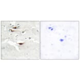 Immunohistochemistry - Anti-IPPK Antibody (C11708) - Antibodies.com