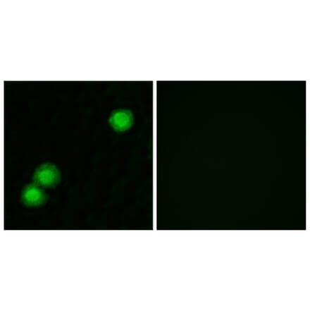 Immunofluorescence - Anti-IPKB Antibody (C11657) - Antibodies.com