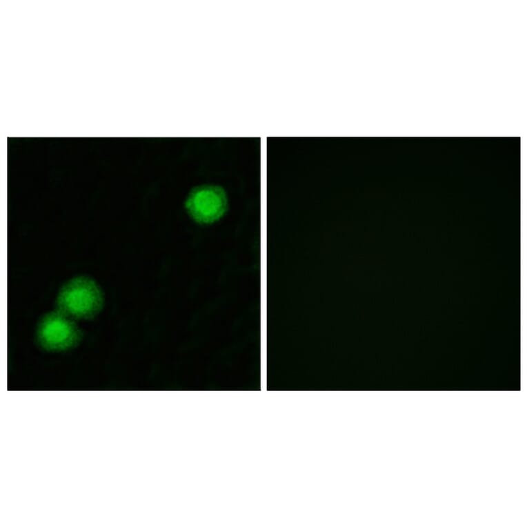 Immunofluorescence - Anti-IPKB Antibody (C11657) - Antibodies.com