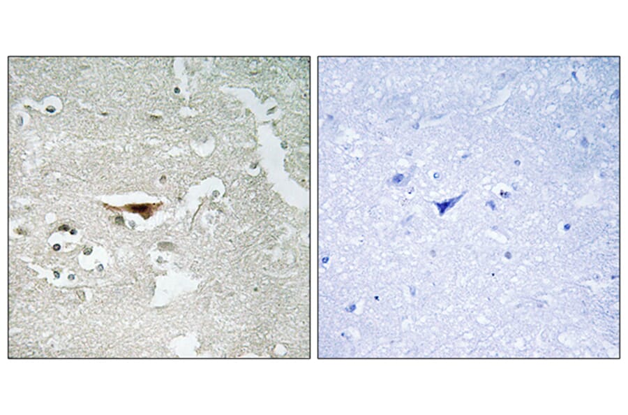 Immunohistochemistry - Anti-IPKB Antibody (C11657) - Antibodies.com