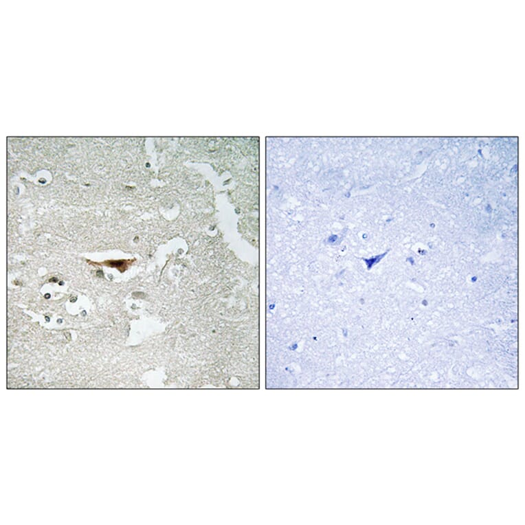 Immunohistochemistry - Anti-IPKB Antibody (C11657) - Antibodies.com