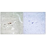 Immunohistochemistry - Anti-IPKB Antibody (C11657) - Antibodies.com