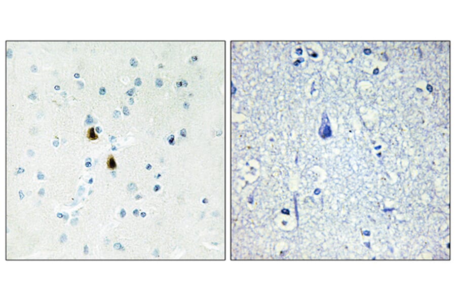 Immunohistochemistry - Anti-IPKA Antibody (C10772) - Antibodies.com