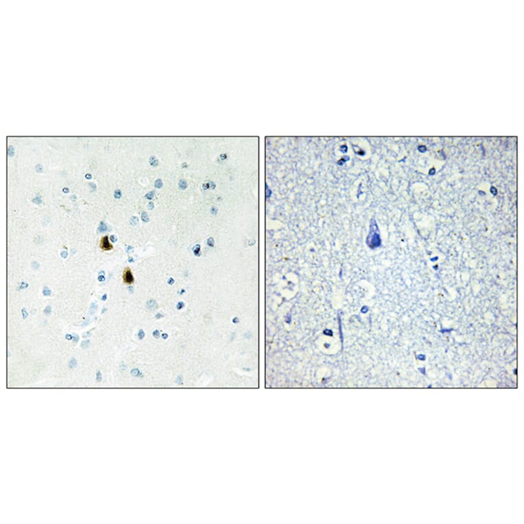 Immunohistochemistry - Anti-IPKA Antibody (C10772) - Antibodies.com