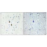 Immunohistochemistry - Anti-IPKA Antibody (C10772) - Antibodies.com