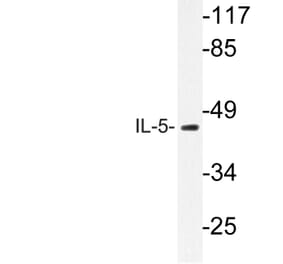 Western Blot - Anti-IL-5 Antibody (R12-2212) - Antibodies.com