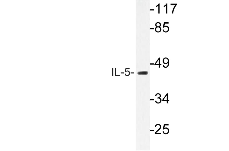 Western Blot - Anti-IL-5 Antibody (R12-2212) - Antibodies.com