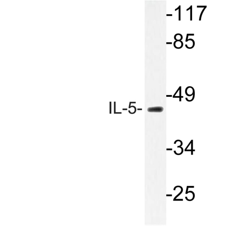 Western Blot - Anti-IL-5 Antibody (R12-2212) - Antibodies.com