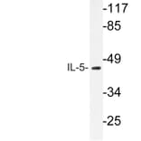 Western Blot - Anti-IL-5 Antibody (R12-2212) - Antibodies.com