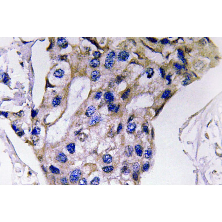 Immunohistochemistry - Anti-IL-5 Antibody (R12-2212) - Antibodies.com