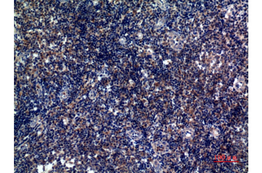 Immunohistochemistry - Anti-ICOS Antibody (C30444) - Antibodies.com
