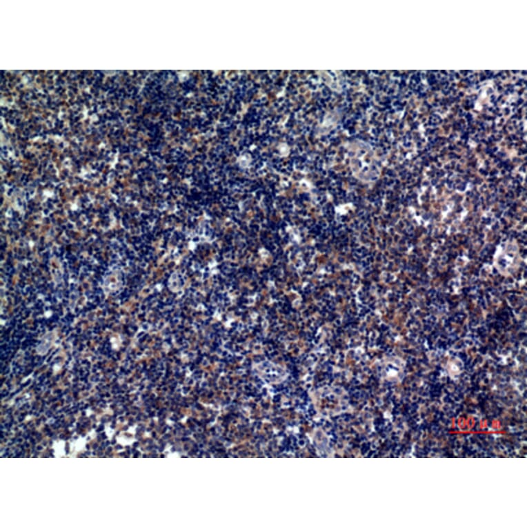 Immunohistochemistry - Anti-ICOS Antibody (C30444) - Antibodies.com