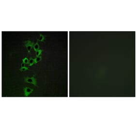 Immunofluorescence - Anti-HER4 Antibody (B0947) - Antibodies.com