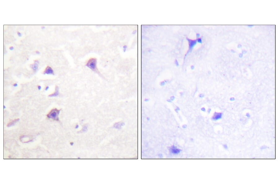 Immunohistochemistry - Anti-HER4 Antibody (B0947) - Antibodies.com