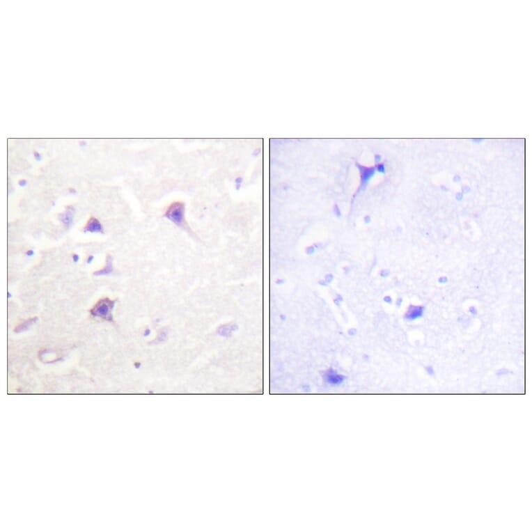 Immunohistochemistry - Anti-HER4 Antibody (B0947) - Antibodies.com