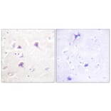 Immunohistochemistry - Anti-HER4 Antibody (B0947) - Antibodies.com