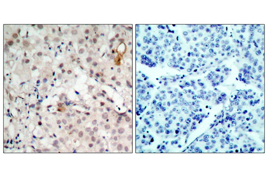 Immunohistochemistry - Anti-HER2 Antibody (B7103) - Antibodies.com