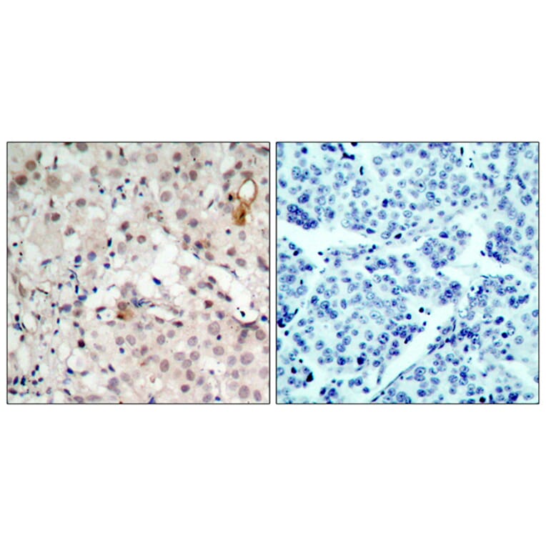 Immunohistochemistry - Anti-HER2 Antibody (B7103) - Antibodies.com