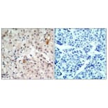 Immunohistochemistry - Anti-HER2 Antibody (B7103) - Antibodies.com