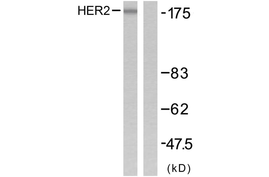 Western Blot - Anti-HER2 Antibody (B7103) - Antibodies.com