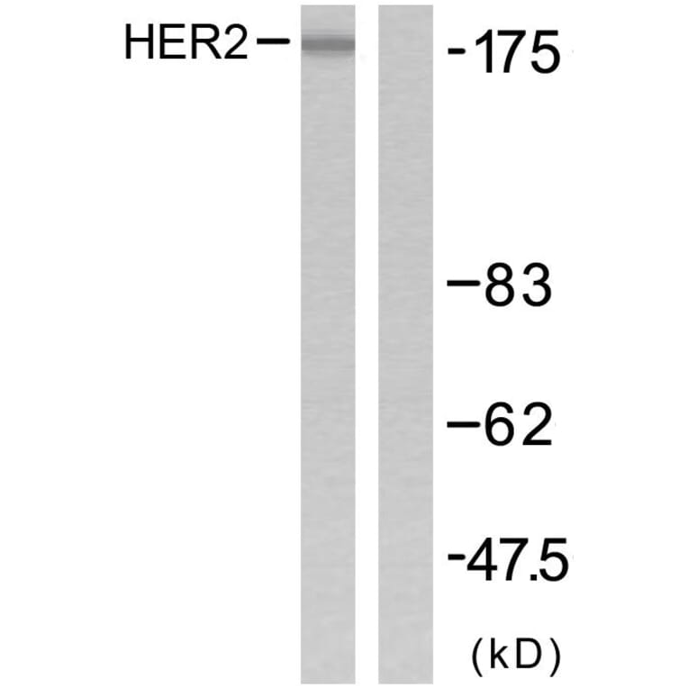 Western Blot - Anti-HER2 Antibody (B7103) - Antibodies.com