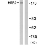 Western Blot - Anti-HER2 Antibody (B7103) - Antibodies.com