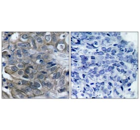 Immunohistochemistry - Anti-HER2 Antibody (B7105) - Antibodies.com