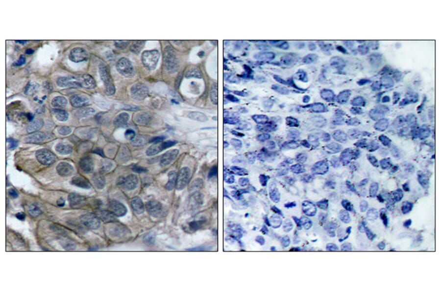Immunohistochemistry - Anti-HER2 Antibody (B7105) - Antibodies.com