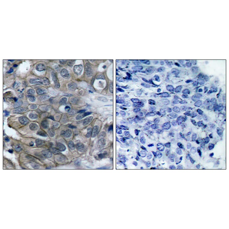 Immunohistochemistry - Anti-HER2 Antibody (B7105) - Antibodies.com