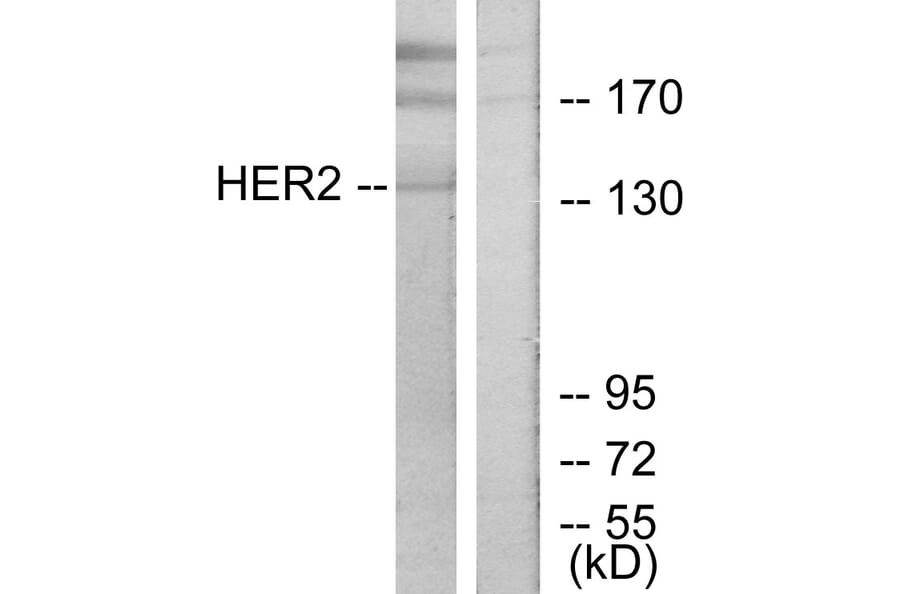Western Blot - Anti-HER2 Antibody (B7105) - Antibodies.com