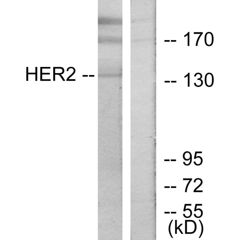 Western Blot - Anti-HER2 Antibody (B7105) - Antibodies.com