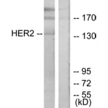 Western Blot - Anti-HER2 Antibody (B7105) - Antibodies.com