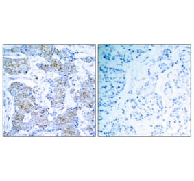 Immunohistochemistry - Anti-HER2 Antibody (B7104) - Antibodies.com