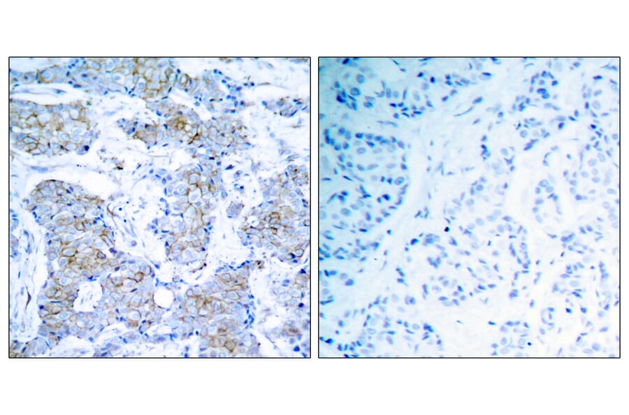 Immunohistochemistry - Anti-HER2 Antibody (B7104) - Antibodies.com
