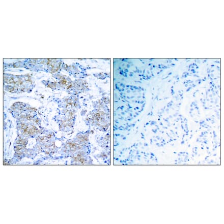 Immunohistochemistry - Anti-HER2 Antibody (B7104) - Antibodies.com