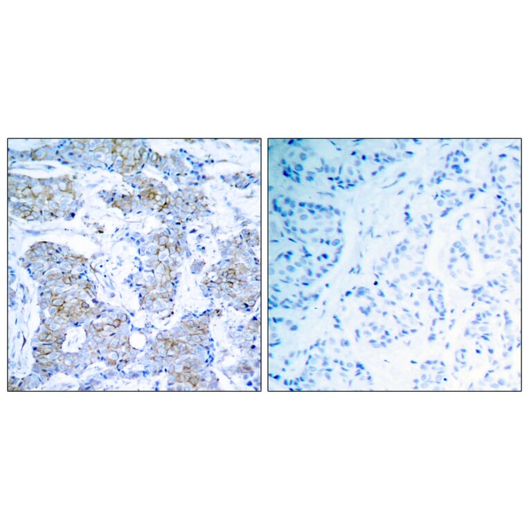 Immunohistochemistry - Anti-HER2 Antibody (B7104) - Antibodies.com