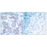 Immunohistochemistry - Anti-HER2 Antibody (B7104) - Antibodies.com