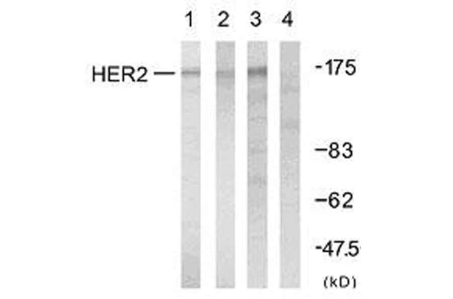 Western Blot - Anti-HER2 Antibody (B7104) - Antibodies.com