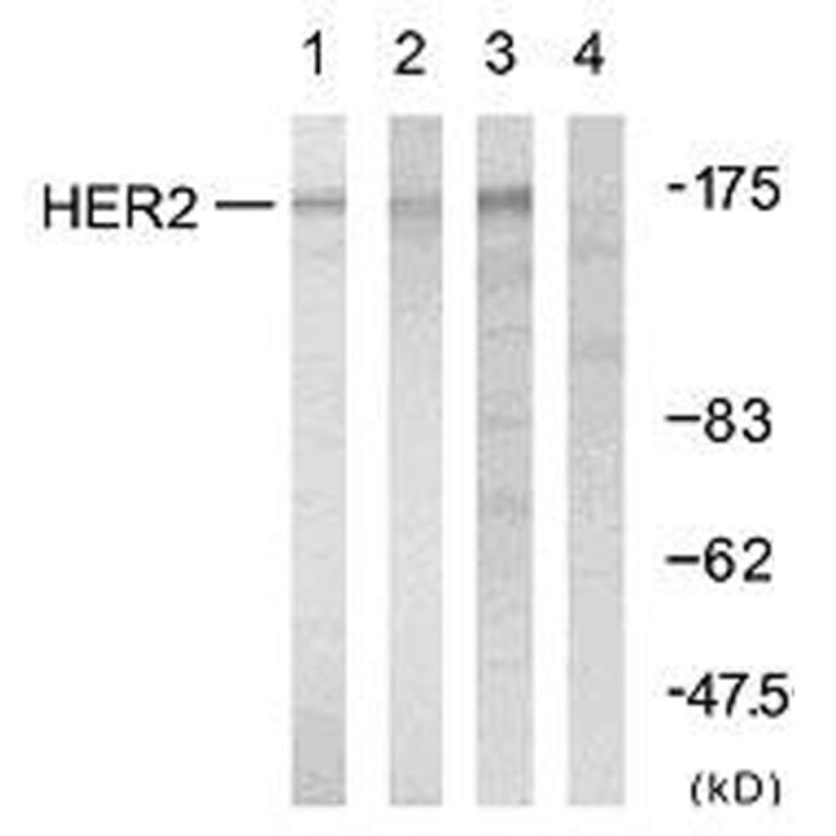 Western Blot - Anti-HER2 Antibody (B7104) - Antibodies.com