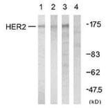 Western Blot - Anti-HER2 Antibody (B7104) - Antibodies.com