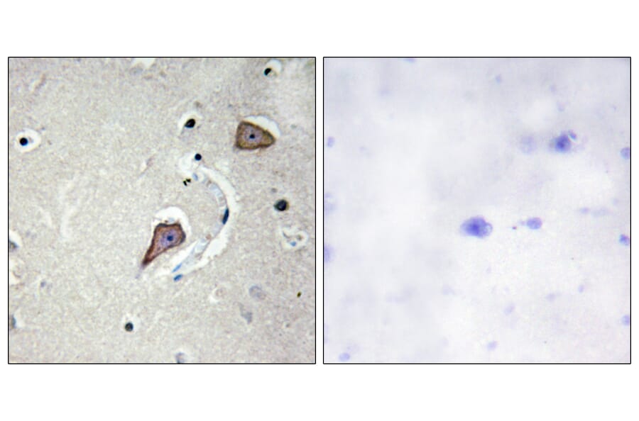 Immunohistochemistry - Anti-HER2 Antibody (B0942) - Antibodies.com