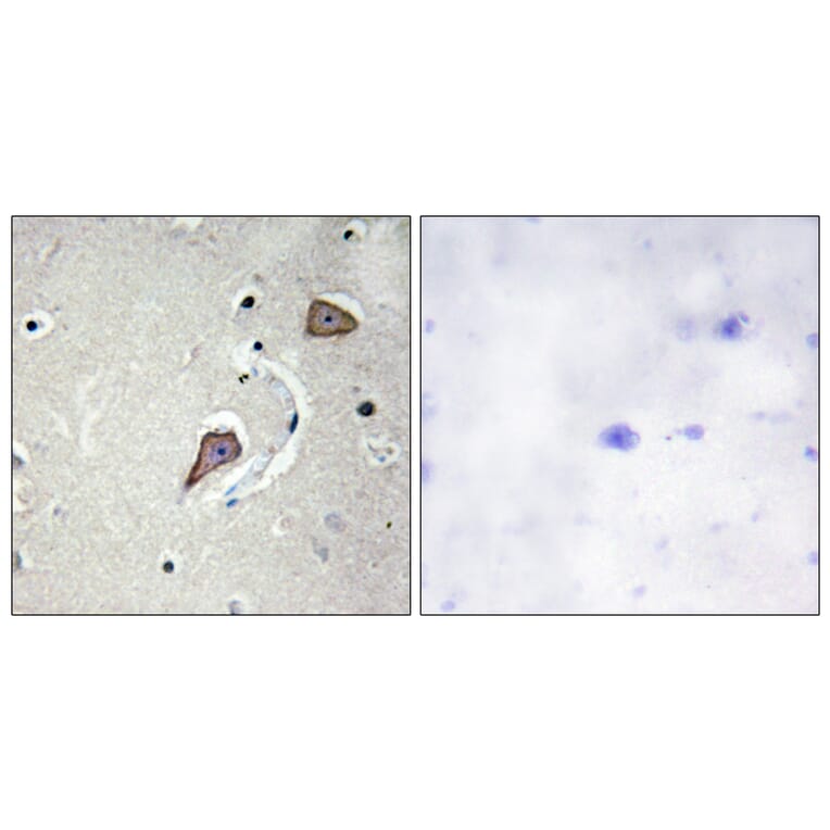 Immunohistochemistry - Anti-HER2 Antibody (B0942) - Antibodies.com